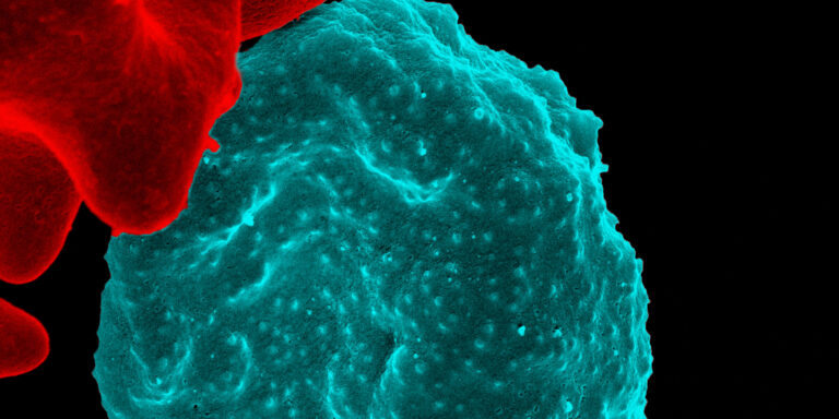 Malaria infected red blood cell